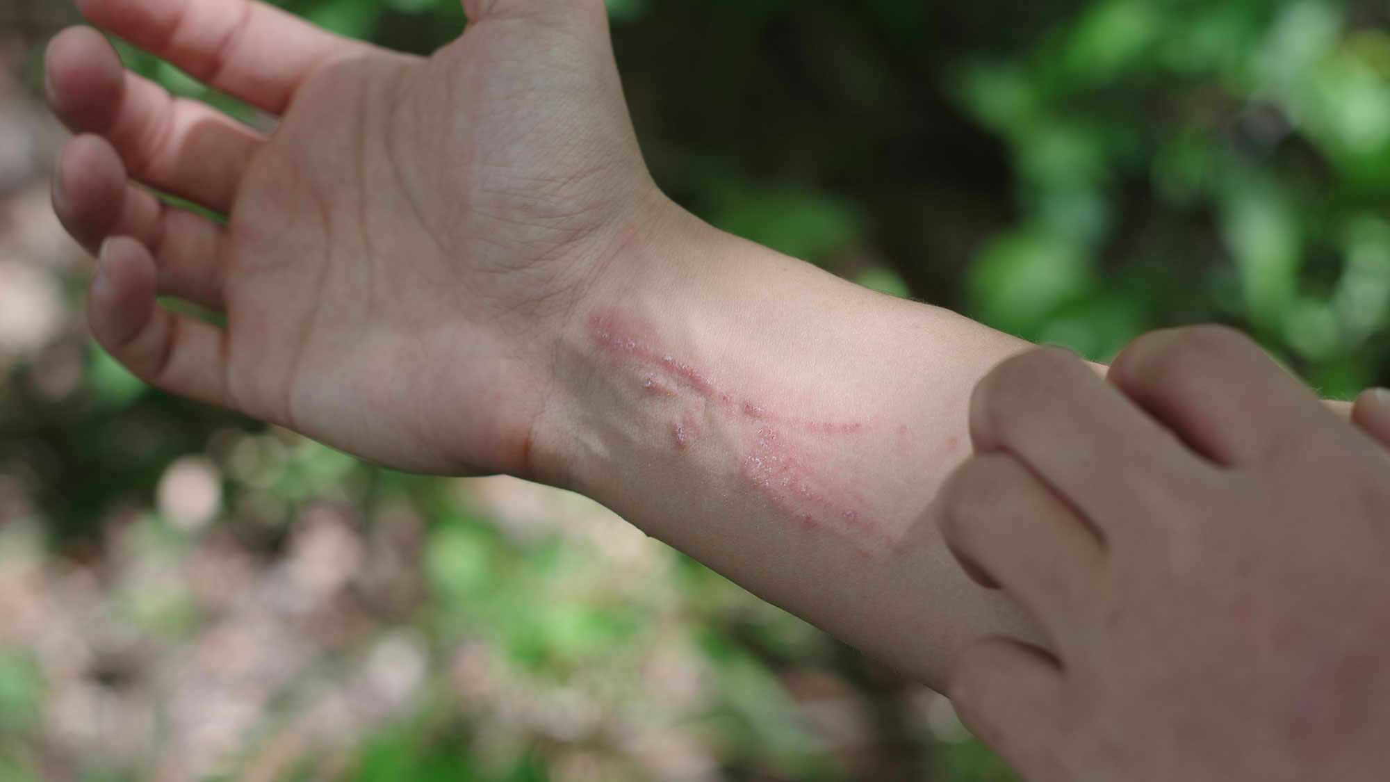 Comment identifier le poison Ivy avec l'IA – ne jamais obtenir une éruption cutanée image-29674