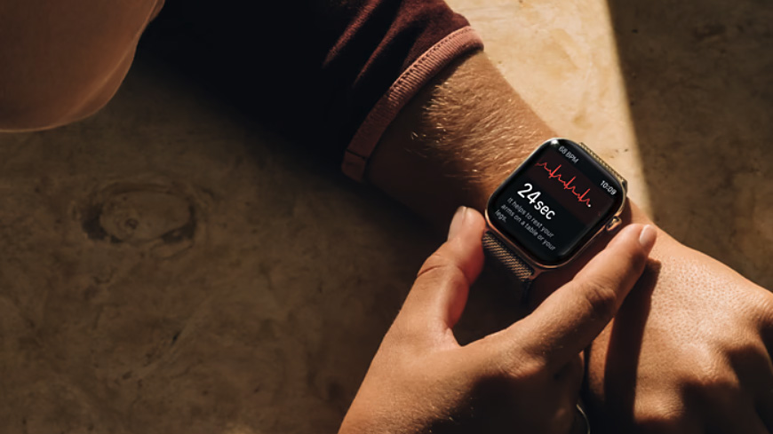 Gros plan d'une lecture ECG effectuée à l'aide de l'Apple Watch Series 12